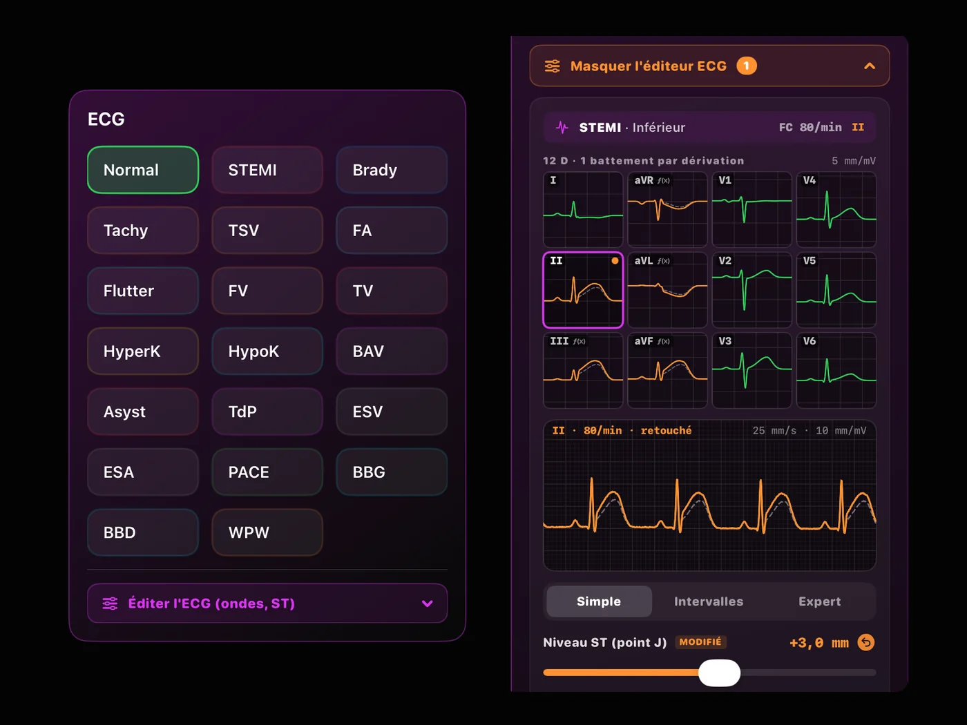 Grille des 20 rythmes ECG et éditeur d'ondes : STEMI inférieur, 12 dérivations, curseur du niveau ST