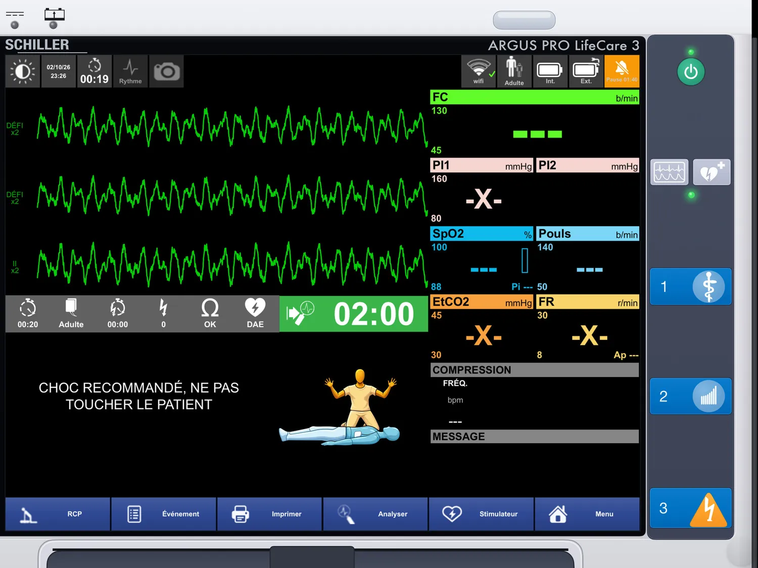 ARGUS PRO LifeCare 3 — DAE : choc recommandé
