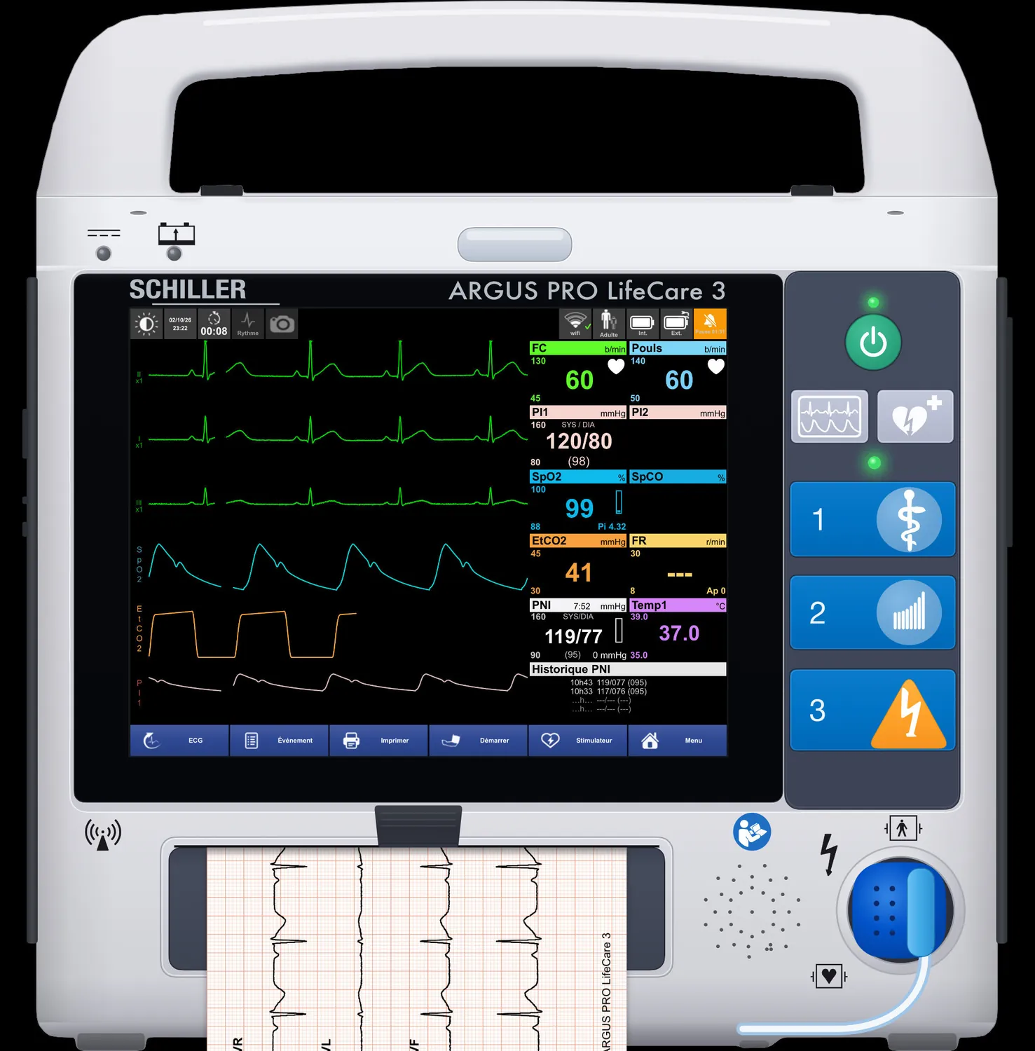 ARGUS PRO LifeCare 3 — Impression papier : l'ECG 12 dérivations sort de la fente