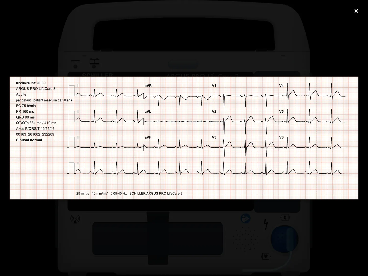ARGUS PRO LifeCare 3 — Le tracé imprimé, lu à l'écran