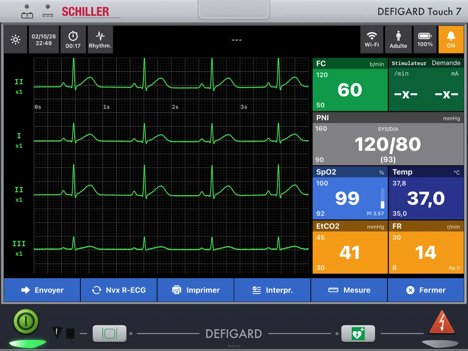 DEFIGARD Touch 7 — ECG 12 dérivations