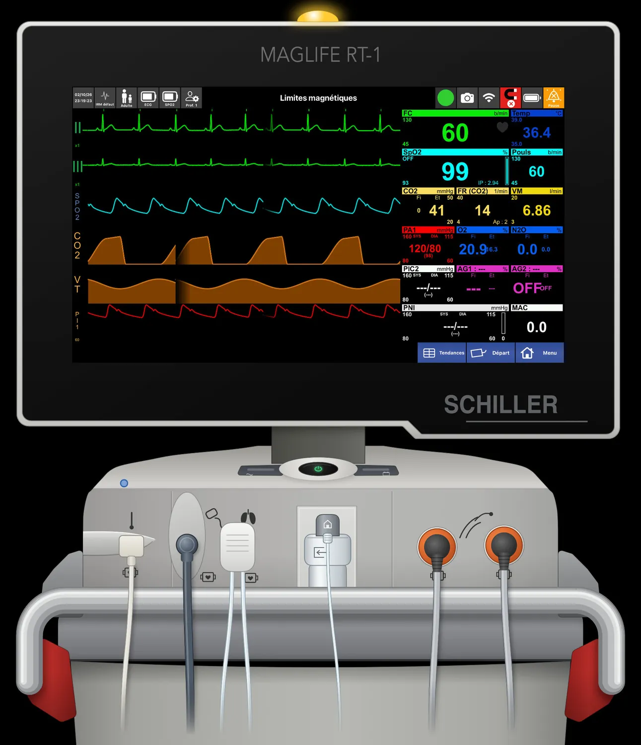 MAGLIFE RT-1 — Alarme : limites magnétiques