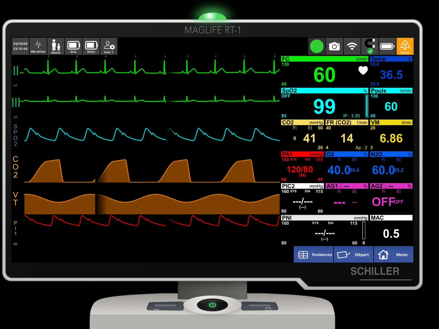 MAGLIFE RT-1 — Monitorage et gaz