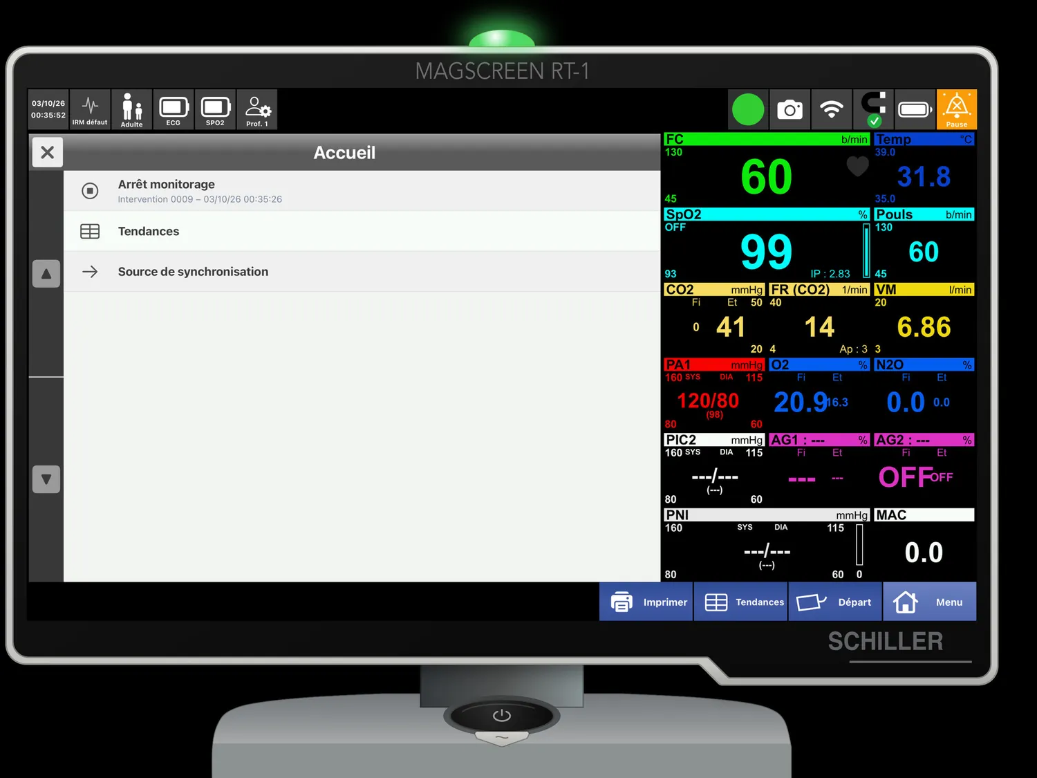 MAGSCREEN RT-1 — Menu d'accueil : arrêt, tendances