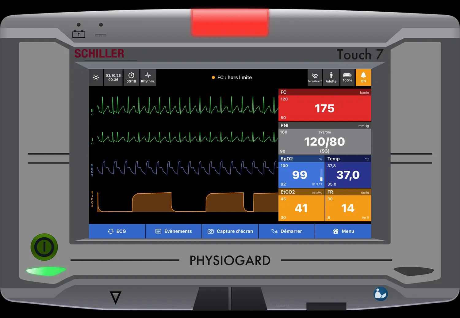 PHYSIOGARD Touch 7 — Alarme haute : voyant rouge, FC hors limite