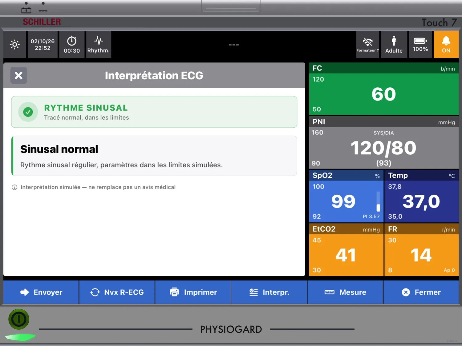 PHYSIOGARD Touch 7 — Interprétation simulée du tracé