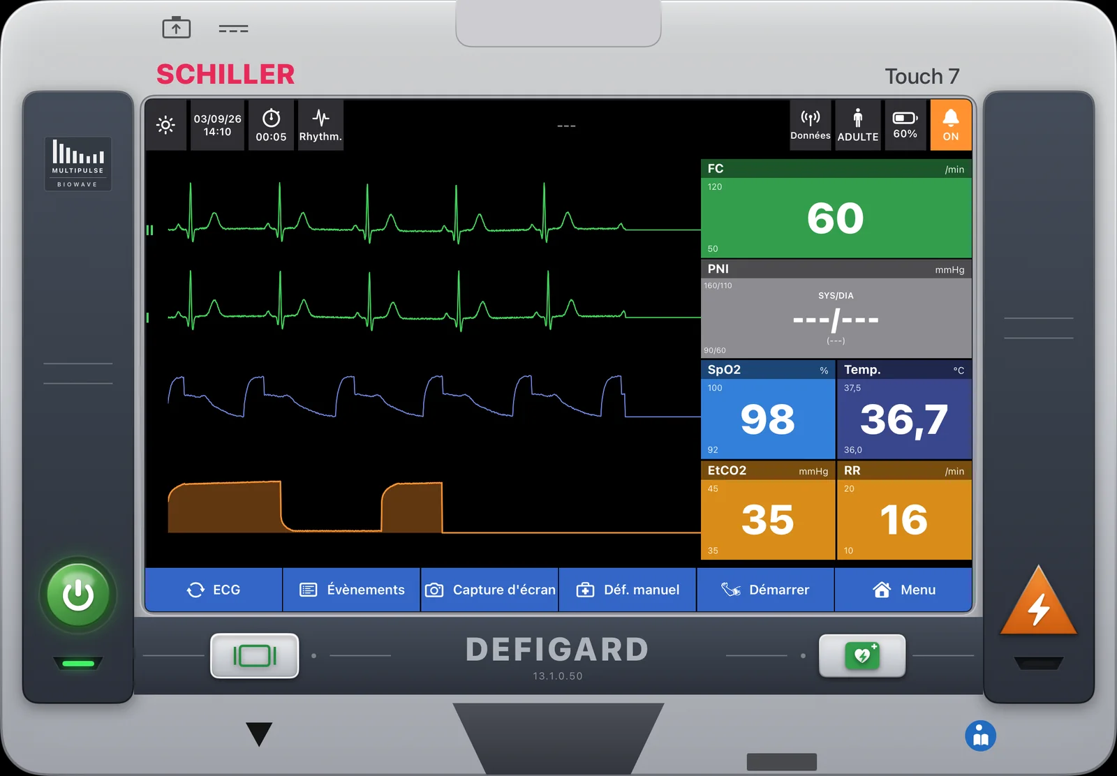 Interface Schiller DEFIGARD Touch 7 reproduite dans le scope VitalX