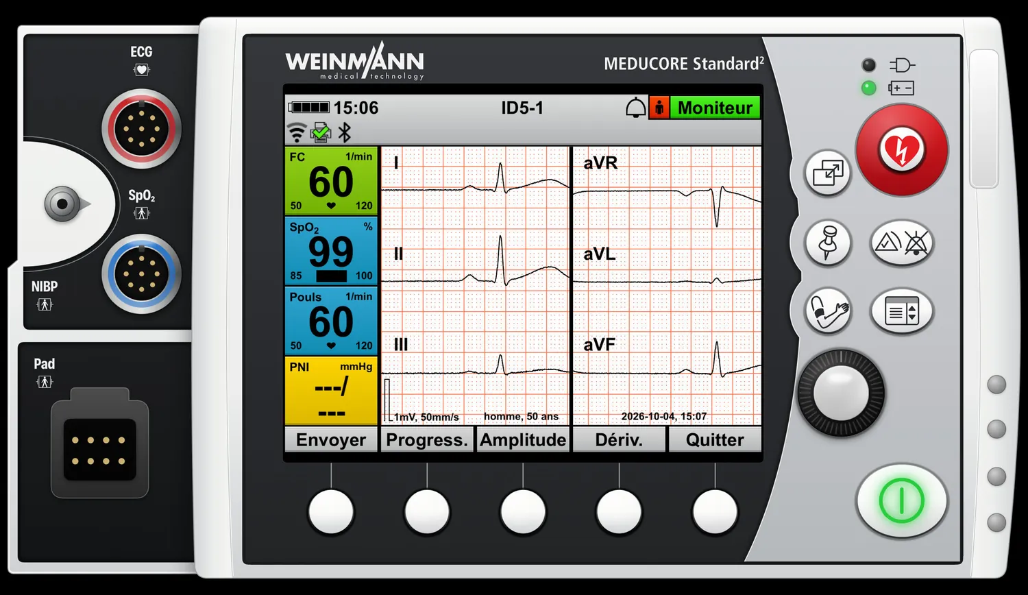 MEDUCORE Standard² — ECG 12 dérivations — résultats